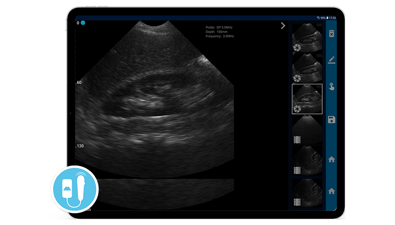 VistaScan · Ultrasonido Portátil con Aprobación FDA